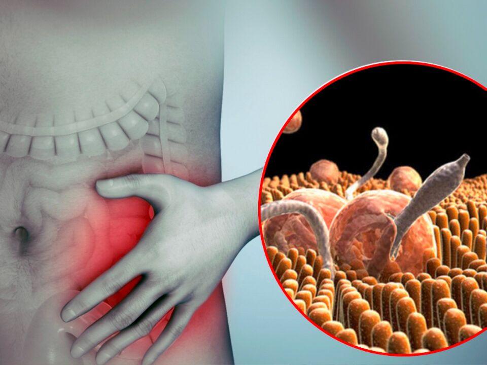 sintomas de parasitas no corpo